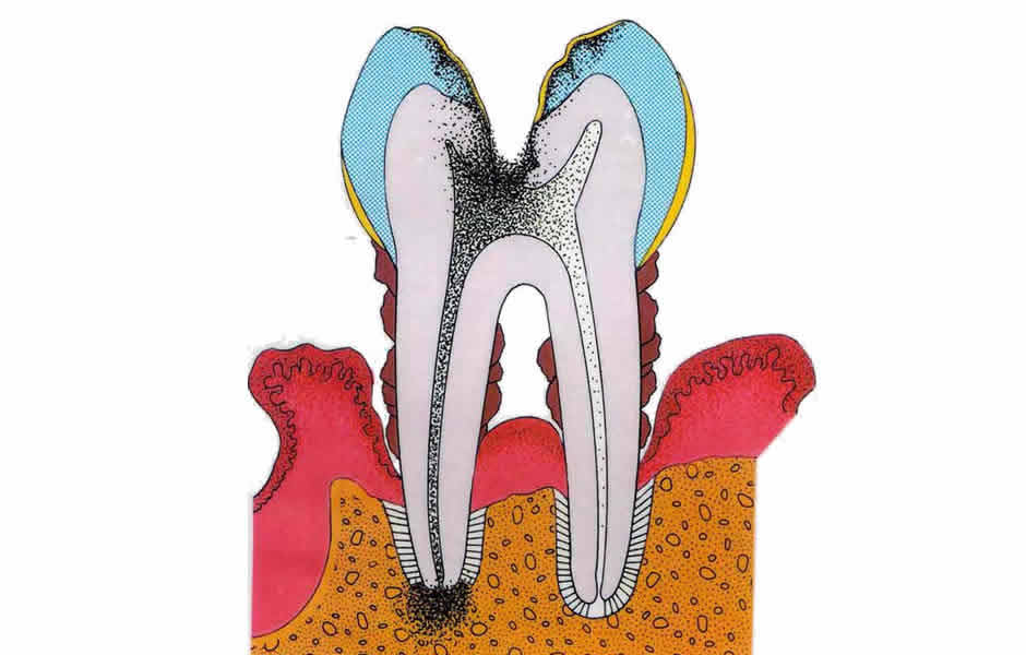 periodontoloji